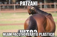 patzani neam facut operatie plastica