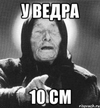 у ведра 10 см