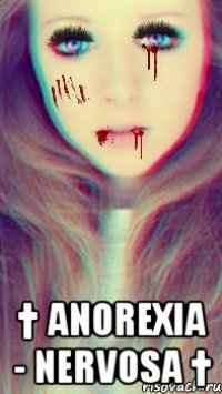  † anorexia - nervosa †
