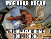 мое лицо, когда у меня деревянный кол в голове