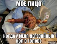 мое лицо когда у меня деревянный кол в голове