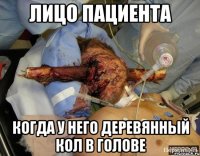 лицо пациента когда у него деревянный кол в голове