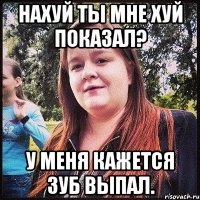 нахуй ты мне хуй показал? у меня кажется зуб выпал.