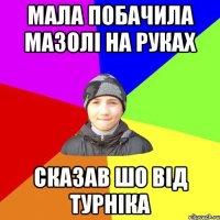 мала побачила мазолі на руках сказав шо від турніка