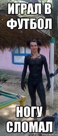 играл в футбол ногу сломал