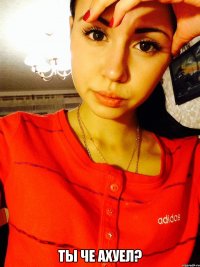  Ты че ахуел?