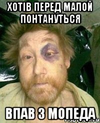 хотів перед малой понтануться впав з мопеда