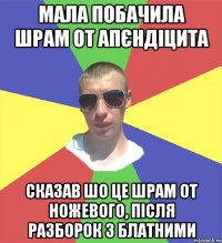 мала побачила шрам от апєндіцита сказав шо це шрам от ножевого, після разборок з блатними