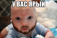 у вас ярый 