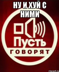ну и хуй с ними 
