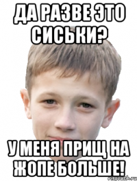 Да разве это сиськи? У меня прищ на жопе больше!