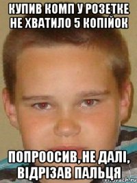 купив комп у розетке не хватило 5 копійок попроосив, не далі, Відрізав пальця