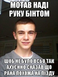 мотав наді руку бінтом шоб не було всьо так ахуєнно сказав що рана похожа на пізду