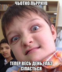 Чьотко пьррнув Тепер весь день глаз сіпається