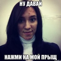 ну давай нажми на мой прыщ