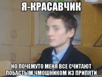 Я-красавчик но почемуто меня все считают лобастым чмошником из Припяти
