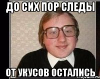 До сих пор следы От укусов остались