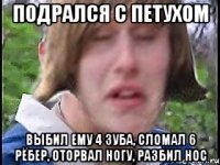 Подрался с петухом Выбил ему 4 зуба, сломал 6 рёбер, оторвал ногу, разбил нос