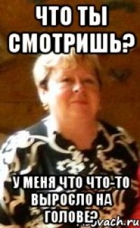 Что ты смотришь? У меня что что-то выросло на голове?