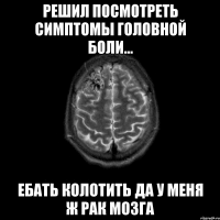 Решил посмотреть симптомы головной боли... Ебать колотить да у меня ж рак мозга