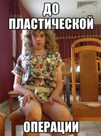 ДО ПЛАСТИЧЕСКОЙ ОПЕРАЦИИ