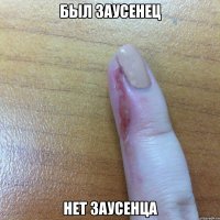 БЫЛ ЗАУСЕНЕЦ НЕТ ЗАУСЕНЦА