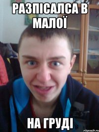Разпісалса в малої На груді