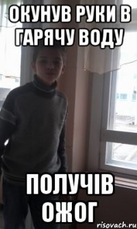 окунув руки в гарячу воду получів ожог