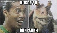 после до опирации