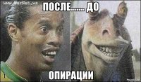после....... до опирации
