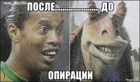 после....................... до опирации