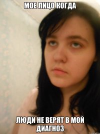 Мое лицо когда Люди не верят в мой диагноз