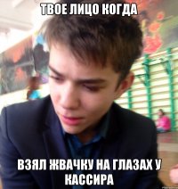 твое лицо когда взял жвачку на глазах у кассира