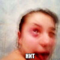  Нит