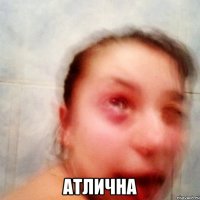  Атлична