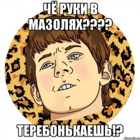 Чё руки в мазолях???? ТЕРЕБОНЬКАЕШЬ!?