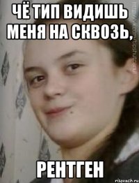 чё тип видишь меня на сквозь, рентген