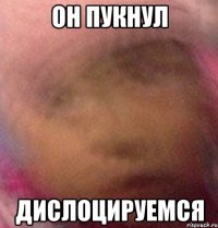ОН ПУКНУЛ дислоцируемся