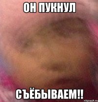 ОН ПУКНУЛ съёбываем!!