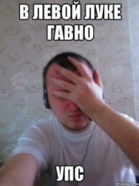 в левой луке гавно упс