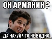 Он армянин ? Да нахуй что не видно