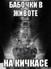 бабочки в животе на кичкасе
