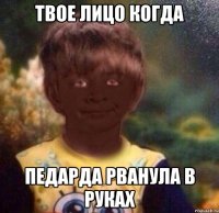 Твое лицо когда Педарда рванула в руках