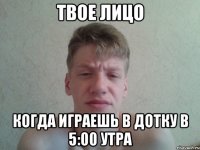 Твое лицо Когда играешь в дотку в 5:00 утра