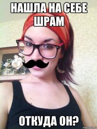 Нашла на себе шрам Откуда он?