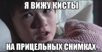 Я вижу КИСТЫ На прицельных снимках