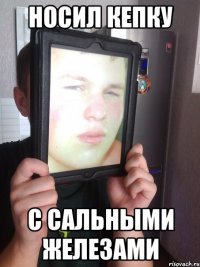 носил кепку с сальными железами