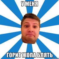 у меня горит жопа блять