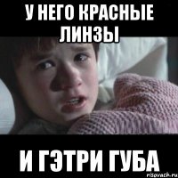 У НЕГО КРАСНЫЕ ЛИНЗЫ И ГЭТРИ ГУБА