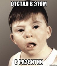 отстал в этом в развитии